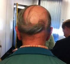Inspired by call of duty and impact (as the cod logo is). Balding Men Share Funny Photos Of Their Hair Raisingly Bad Comb Overs