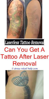 Tattoodo's informational guide this time introduces you to laser removal which is the most efficient way to get rid of your tattoo. How Much Is It To Get Laser Tattoo Removal What Does A Laser Removed Tattoo Look Like Where Can You Get A Tatto Tattoo Removal Cost Tattoo Removal Laser Tattoo