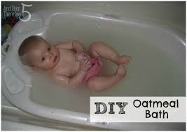 Although a child left in a wet or soiled diaper for too long is more likely to develop diaper. 22 Best Baby Diaper Rash Diy Creams Baths Ideas Diaper Rash New Baby Products Diaper