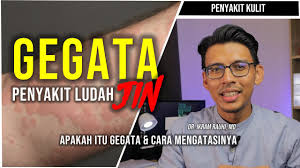 Cara menghilangkan panu di wajah selanjutnya adalah dengan menggunakan bawang putih. Gegata Sopak Garam Betul Ke Disebabkan Oleh Ludah Jin Ubat Dan Cara Menghilangkan Gegata Youtube