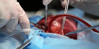 Medical Health Check Up Department Health Checkup Ahmedabad Health Checkup Packages In Ahmedabad Complete Health Checkup Package Ahmedabad Best Health Checkup In Ahmedabad Full Body Checkup In Ahmedabad