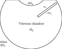 Geometry of the vitreous chamber of the human eye (Ω 2 ), hyaloid...