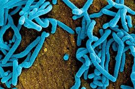 Feb 23, 2021 · ebola virus disease (evd), formerly known as ebola haemorrhagic fever, is a rare but severe, often fatal illness in humans. L8e5u Y0rffmvm
