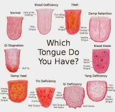What The Color Of Your Tongue Says About Your Health Problems Tongue Health Tongue Sores Tongue Problems