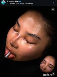 has anyone fitted a front nose skin is it a major job and what did you use  to seal the gaps