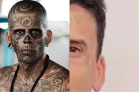 Nova identidade: ex-mais tatuado do Brasil mostra rosto após sessões de  rem... Ver mais