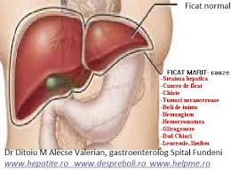 Pacientul poate scădea performanța, dificultatea respirației. Splina Marita Forum Despre ViaÈa Din Romania