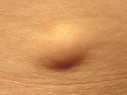 The liver is located at the lower end of the rib cage on the right and the spleen is on the left. Lump On Chest Causes Symptoms And When To Seek Help