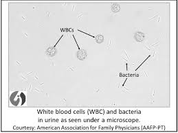 Urinalysis Understand The Test Your Results