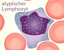 Zu Wenig Lymphozyten Blutwert Lymph Vermindert Zu Niedrig Lymphozytopenie