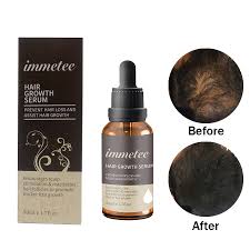 Feel free to switch out the ingredients to suit your needs! Oem 100 Pure Organic Hair Repair Oil Hair Growth Serum Oil China Hair Growth Oil And Hair Repair Oil Price Made In China Com