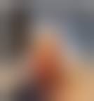 Image result for toe amputation