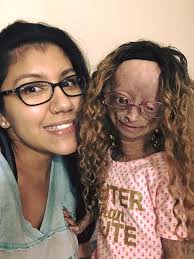 Adalia Rose Naibuzz