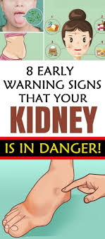 8 Early Warning Signs That Your Kidney Is In Danger Natural Remedies Health Natural Headache Remedies Natural Remedies For Allergies