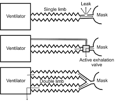 Noninvasive Ventilation For Acute Respiratory