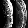 The principles of ms diagnosis are based on showing dissemination of white matter lesions in space and time. Https Encrypted Tbn0 Gstatic Com Images Q Tbn And9gct Ukx9vxdf42wrh6amlcdrv78prqsaihhzljjifqef Wnvdgfq Usqp Cau
