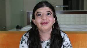 Henny is 1 of 8 people in the world diagnosed with Ehlers-Danlos Type 7C.,  This condition causes her to skin bruise and cut upon contact but Henny  finds beauty in her scars because they symbolize what ...