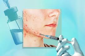 Image result for Injectable Corticosteroid