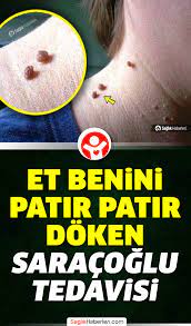 dogal receteler panosundaki pin