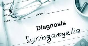 Disability Benefits For Syringomyelia The Bishop Law Firm Spinal Cord Injury Spinal Cord Physical Coordination
