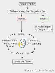 Tinnitus Behandlung Ursachen Symptome Netdoktor
