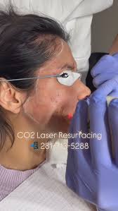 ✨Radiant Dermatology & Aesthetics✨ (@radiantderm) · Instagram 照片和视频