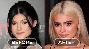 Next kylie jenner before and after plastic surgery october 30, 2020. Celebrities Before And After Plastic Surgery Which Changed Out Of All Recognition By Marta O D Medium