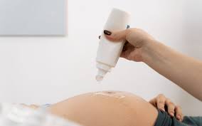So how much does the court allow for 'reasonable expenses'? What To Expect As A Surrogate Mother Through The Surrogacy And Ivf Processes With Gestational Surrogacy In Colorado Adoption And Surrogacy Choices Of Colorado