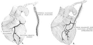 Смотреть что такое diagonal arteries в других словарях: Https Www Sciencedirect Com Science Article Pii S0022522319417984 Pdf Md5 95b8e973d7693fc4d2cba9d96502ae4e Pid 1 S2 0 S0022522319417984 Main Pdf