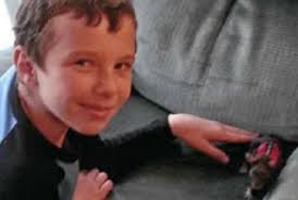 Terinfeksi Bakteri Akibat Digigit Tikus Peliharaan, Bocah Ini Meninggal