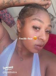 Embrace Your Freckles: A Natural Beauty Statement 🌟