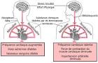 Cours: Bta bloquants - Besancon-cardio.<a name='more'></a> org