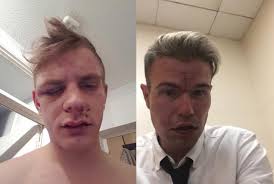 Thugs injure couple in unprovoked homophobic train attack