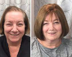 Best Hair Toppers For Women With Thinning Hair Or Hair Loss How To Get Instant Volume To Creat A Beautiful Hair Toppers Thick Hair Solutions Thick Hair Styles