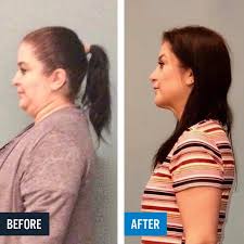 Sota Weight Loss State Of The Art Weightloss Fast Weight Loss