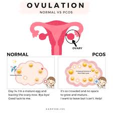 Learn how doctors diagnose and. Pin On Kanpobliss Blog