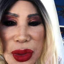 Check spelling or type a new query. Mexican Vedette Lyn May Botchedsurgeries