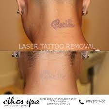 This sub is intended to discuss laser tattoo removal. How Can I Remove My Permanent Tattoo Without Laser