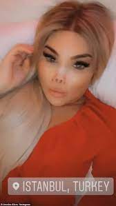 Known globally for her remarkable story of transformation through plastic surgeries. Exc Jessica Alves Has Her Twelfth Nose Job Made From Ear Cartilage Express Digest