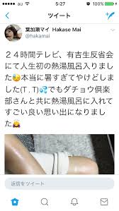 ぱんちょす Twitterren 熱湯風呂でやけどしちゃったってつぶやいてた人あのtw消したのか