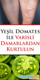 Yesil Domates Ile Varisli Damarlardan Kurtulun Health Herbal Medicine Herbalism