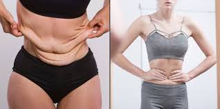 Inilah rahsia bagaimana cara kurus saya sihat, selamat dan berkesan. Biar Kulit Nggak Bergelambir Setelah Susut Berat Badan Ikuti 6 Aturan Mainnya