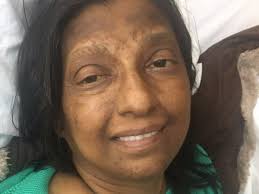 Fundraiser for Vincent Bobo by Gail Matsushima : Susan Bobo