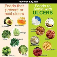 how can you treat the stomach ulcers with home remedies