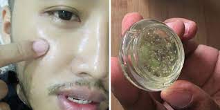 Petua memutihkan muka yang berkesan | wanita sering kali mengingankan kulit wajah atau muka yang putih berseri. Rahsia Kulit Jadi Flawless Bak Putih Telur Perkongsian Lelaki Ini Dikongsi Hampir 25k Netizen Hijabista