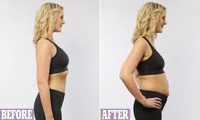 The Slim Women Who Say They Bloat Like A Balloon Bloat Period Bloating Women