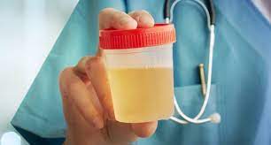 Belum lagi warna air kencing yang pelik ketika hamil. Bingung Membedakan Cairan Ketuban Dan Urine Begini Cara Mudahnya