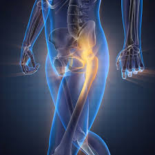 L'arthrose de la hanche altère le quotidien de nombreuses personnes. Arthrose Comment Soulager Les Douleurs De La Hanche Pleine Vie