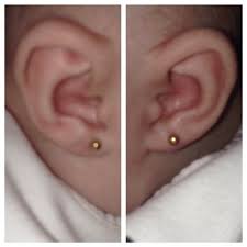 Uneven Ear Piercing Babycenter
