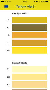 Infant Stool Colour Chart Bedowntowndaytona Com